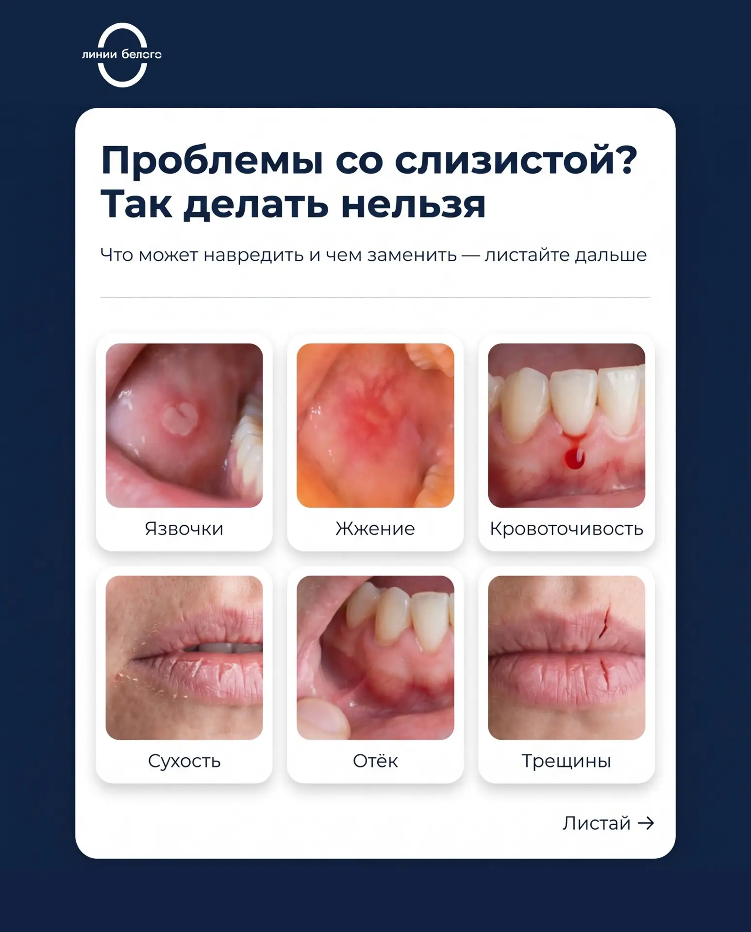 Лечение слизистой полости рта в клинике «Линии Белого». Врач Латыпова Екатерина Ивановна
📍 Екатерин