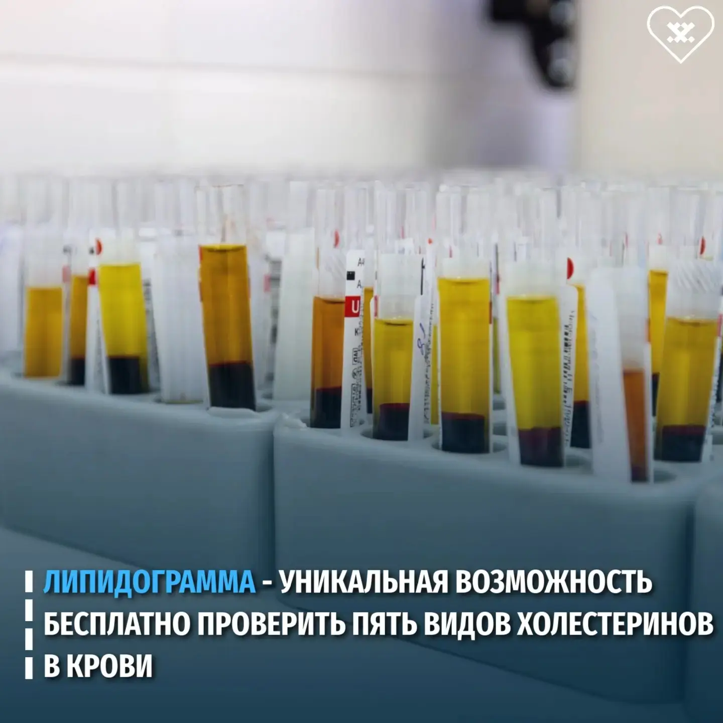 Дорогие ямальцы!  С начала года в восьми городах округа действует проект по ранней диагностике серде