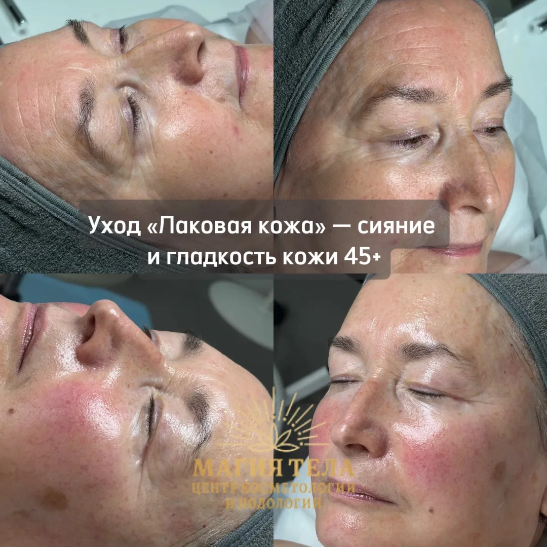 ✨ «Лаковая кожа» 45+ — возраст, когда коже особенно нужен грамотный уход