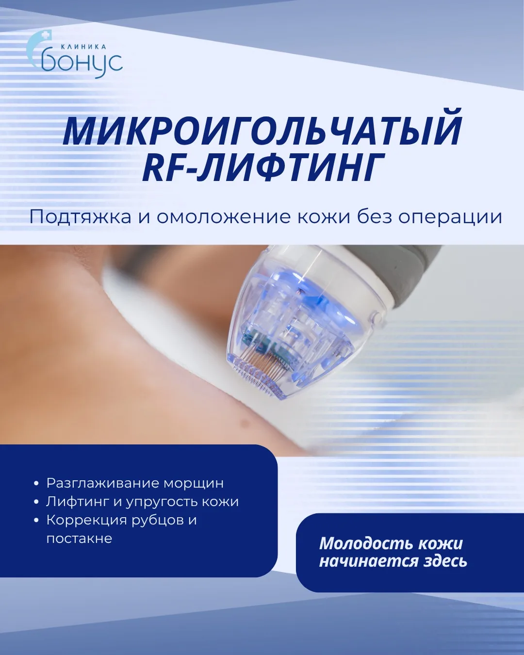 ✨ В КЛИНИКЕ «БОНУС» — НОВИНКА В КОСМЕТОЛОГИИ!

Мы рады сообщить, что в клинике «Бонус» появился совр