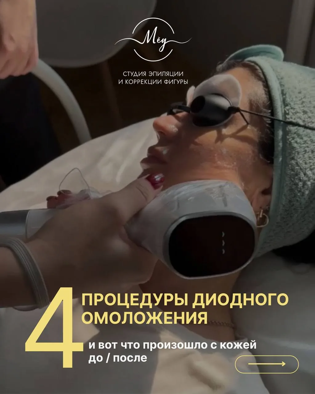4 процедуры — и заметный результат 😱