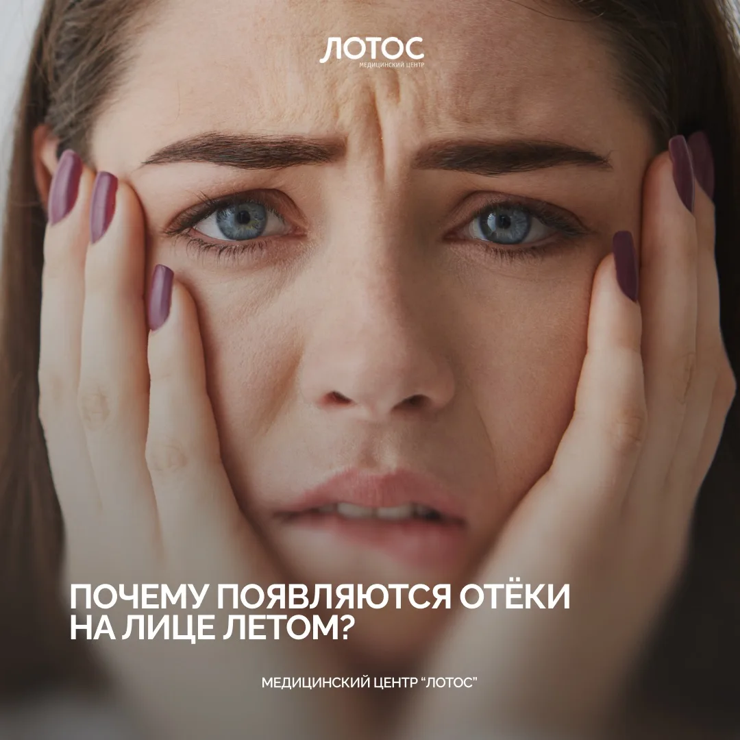 Утром смотрите в зеркало — и не узнаёте своё лицо?