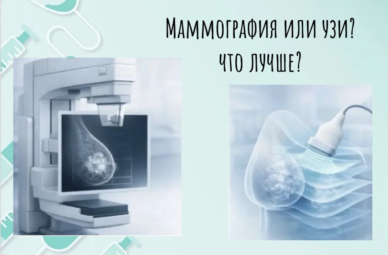 МАММОГРАФИЯ ИЛИ УЗИ? ЧТО ЛУЧШЕ?