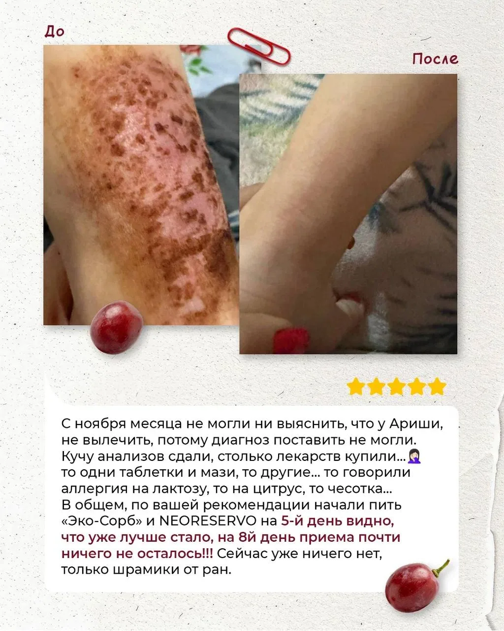 РЕАЛЬНЫЕ ИЗМЕНЕНИЯ С NEORESERVO🍀  Мы собрали ваши отзывы о нашем флагмане🍀, и тут правда есть на что