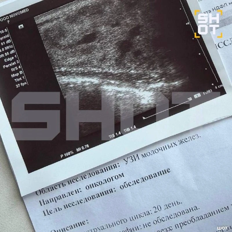 🚨 Поход в баню закончился для молодой мамы опасным воспалением груди

26-летняя жительница Подмоско