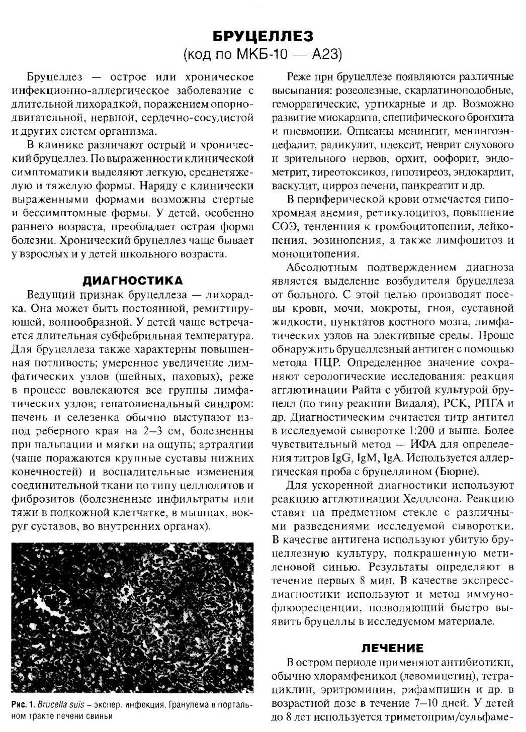 Бруцеллез