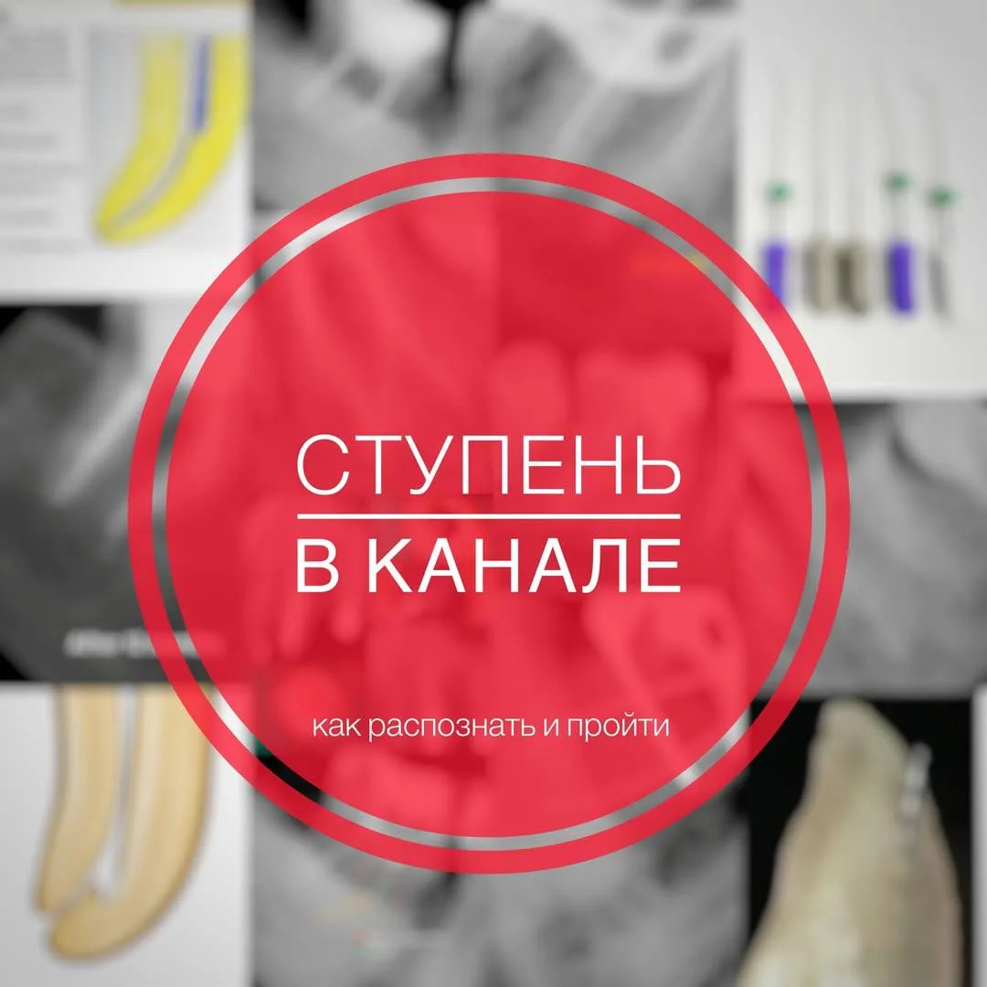 ‼️Ступень в канале