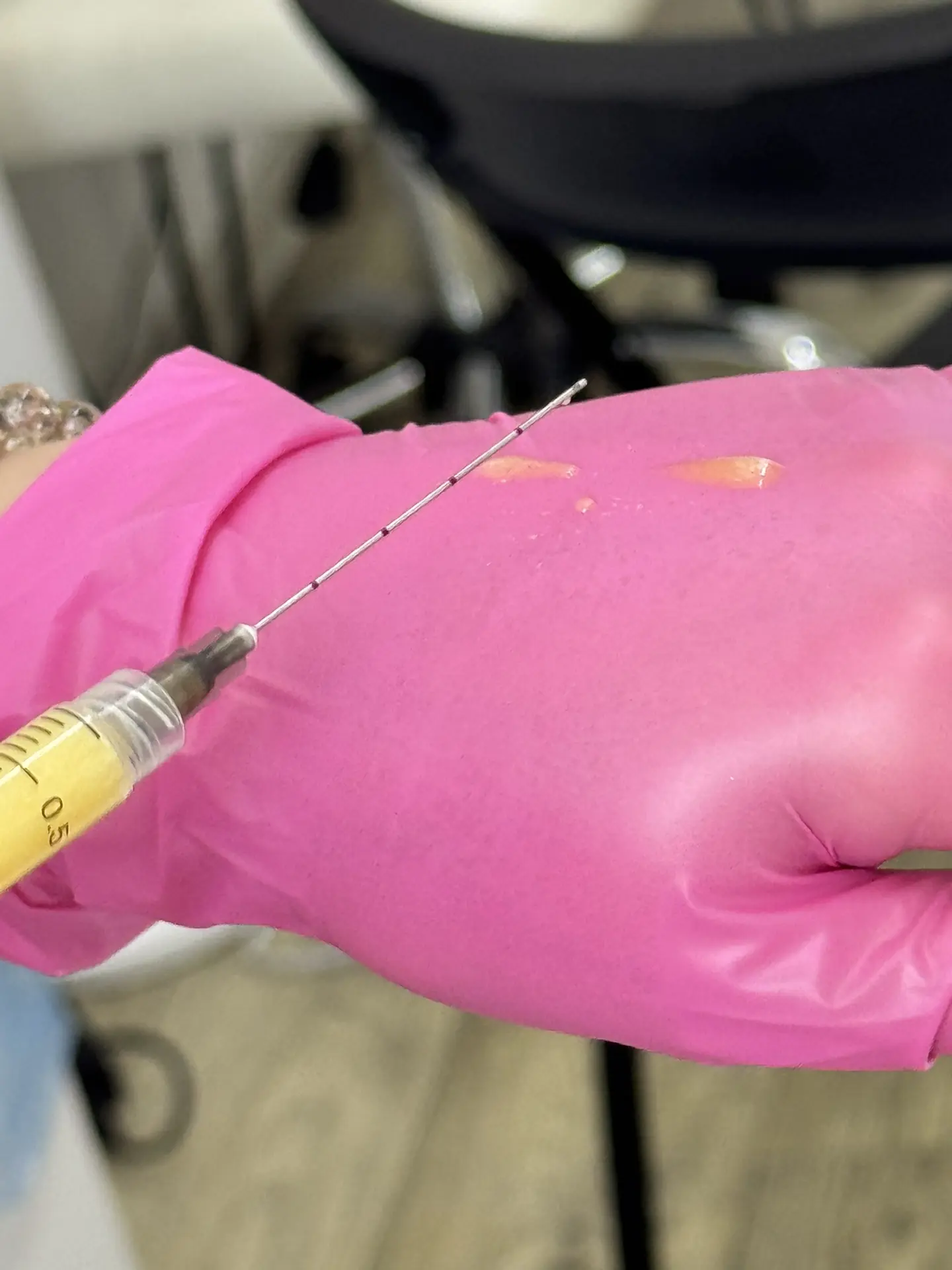 Продолжаем о плазмотерапии 🧑🏼‍🔬