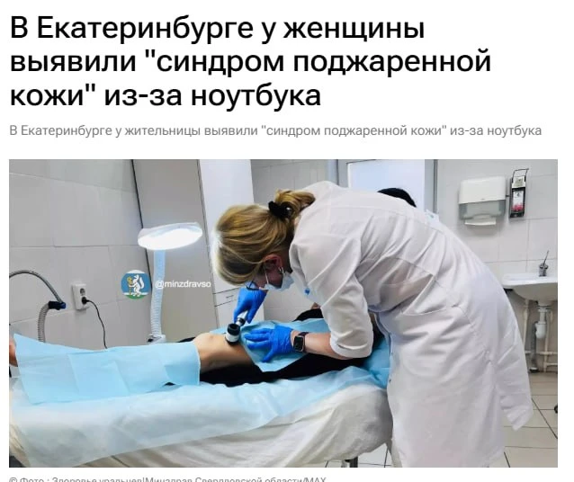 Девушка получила
 ожог от ноутбука из-за УДАЛЁНКИ — ей диагностировали «синдром поджаренной кожи».
З