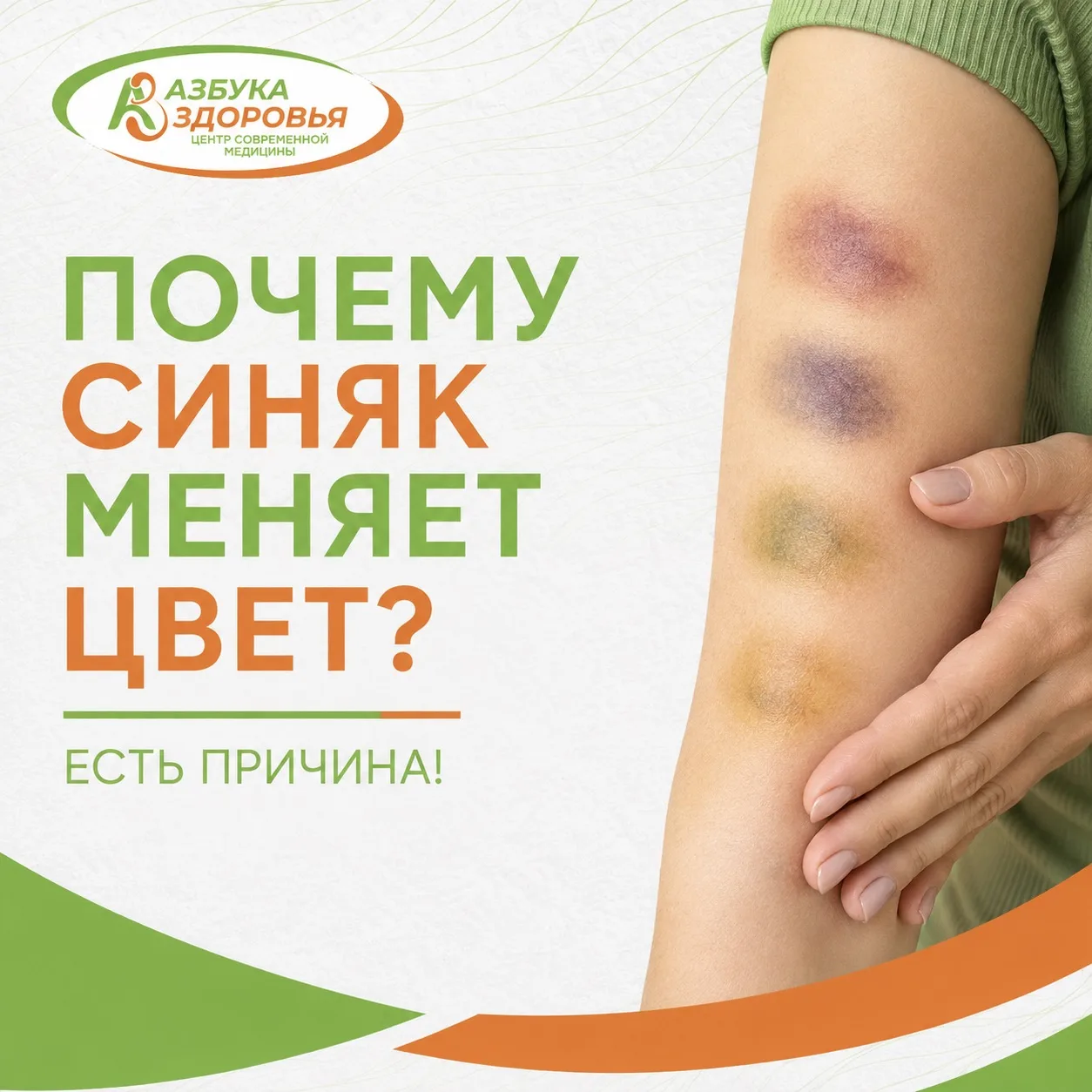 Почему синяк меняет цвет?