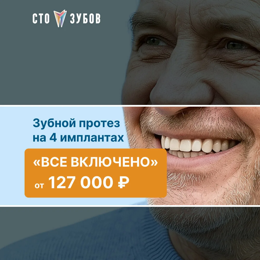 Готовые зубы «под ключ» на 4/6 имплантах в «Сто Зубов»!