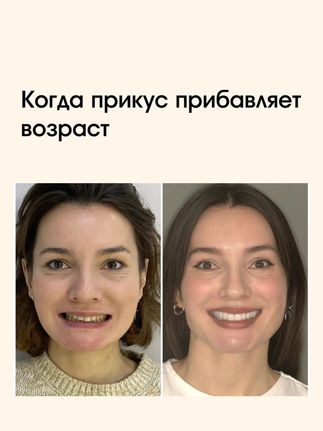 Асимметрия лица — это не только вопрос эстетики.
Когда одна сторона лица работает иначе, чем другая,