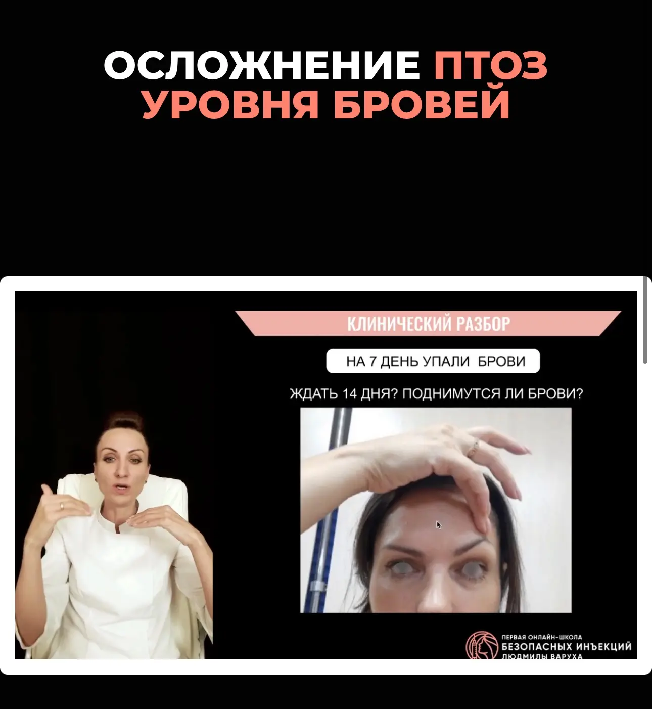 Бесплатный урок курса «Коррекция осложнений после ботулинотерапии» уже доступен для просмотра 🎓

Ко