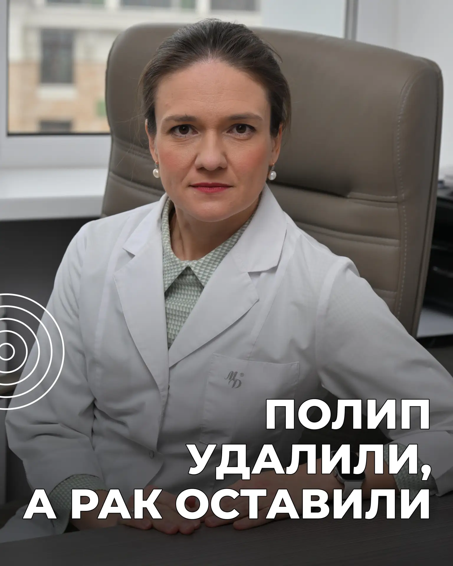 Полип удалили в 2020 году, а в 2026 в лимфоузле — раковая опухоль.