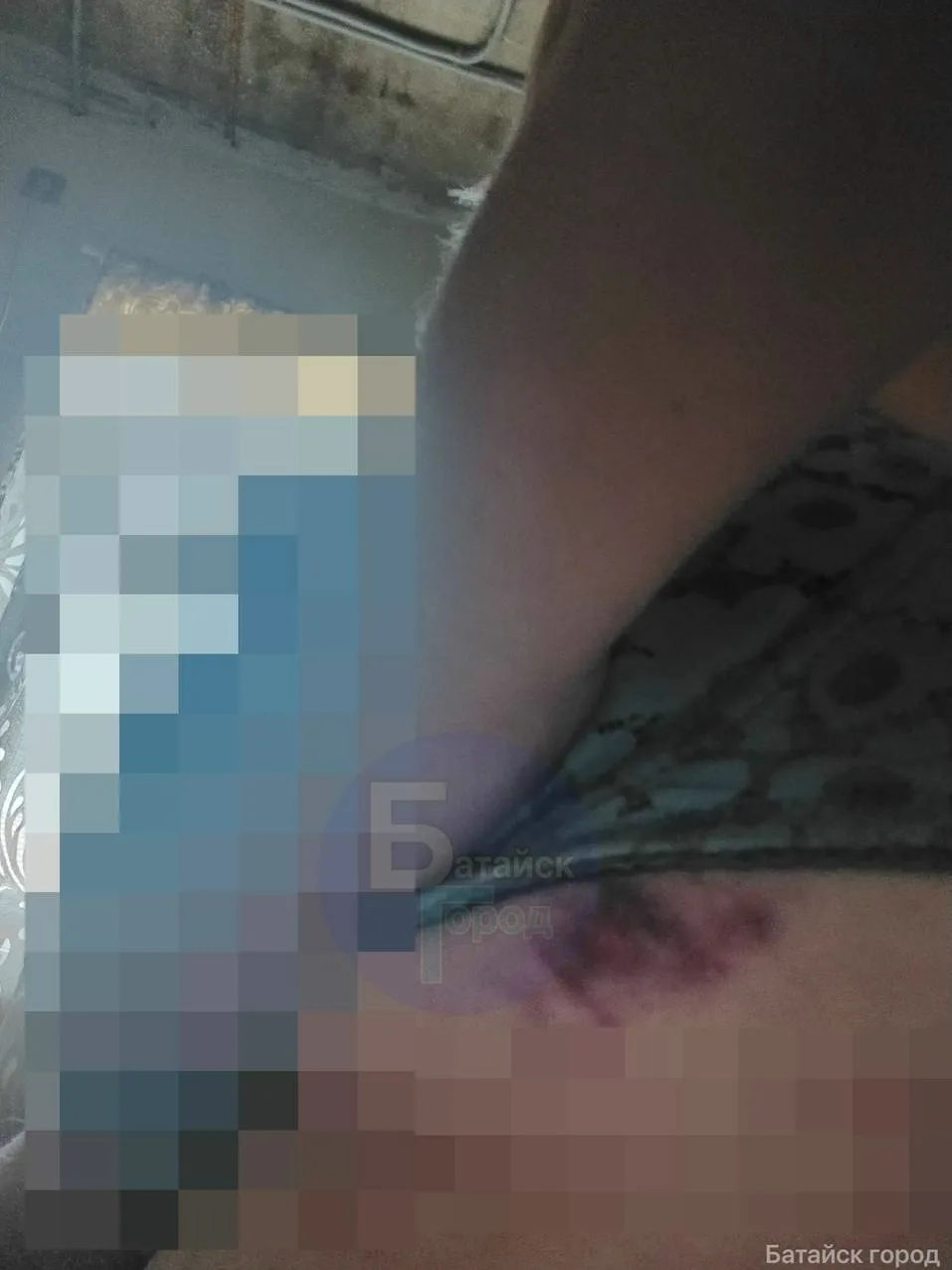Посетительница получила травмы после спуска с горки в аквапарке под Ростовом
