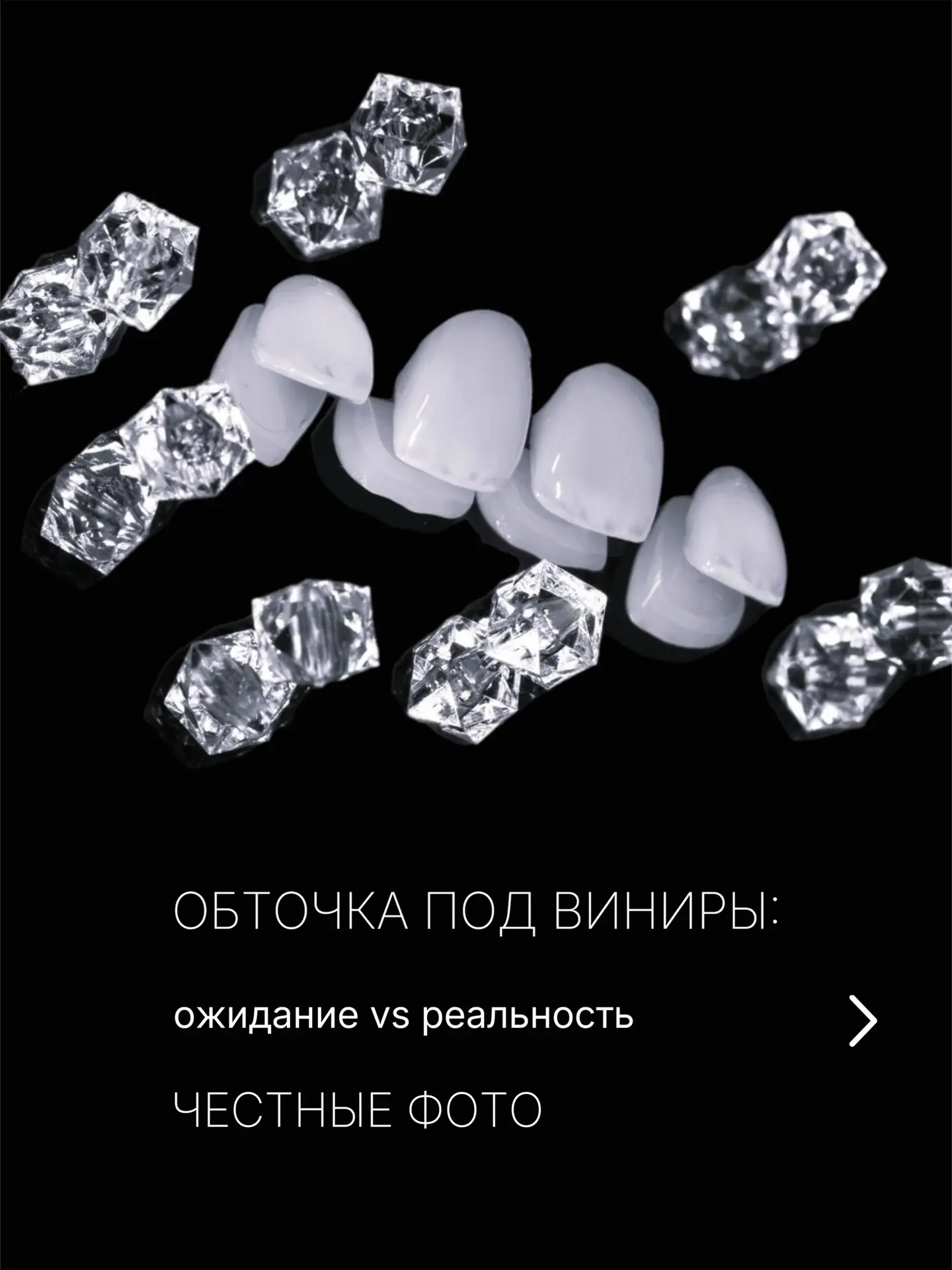 Вы смотрите на наши фото с преображением улыбок и думаете о том, как бы вам подошли сияющие виниры? 