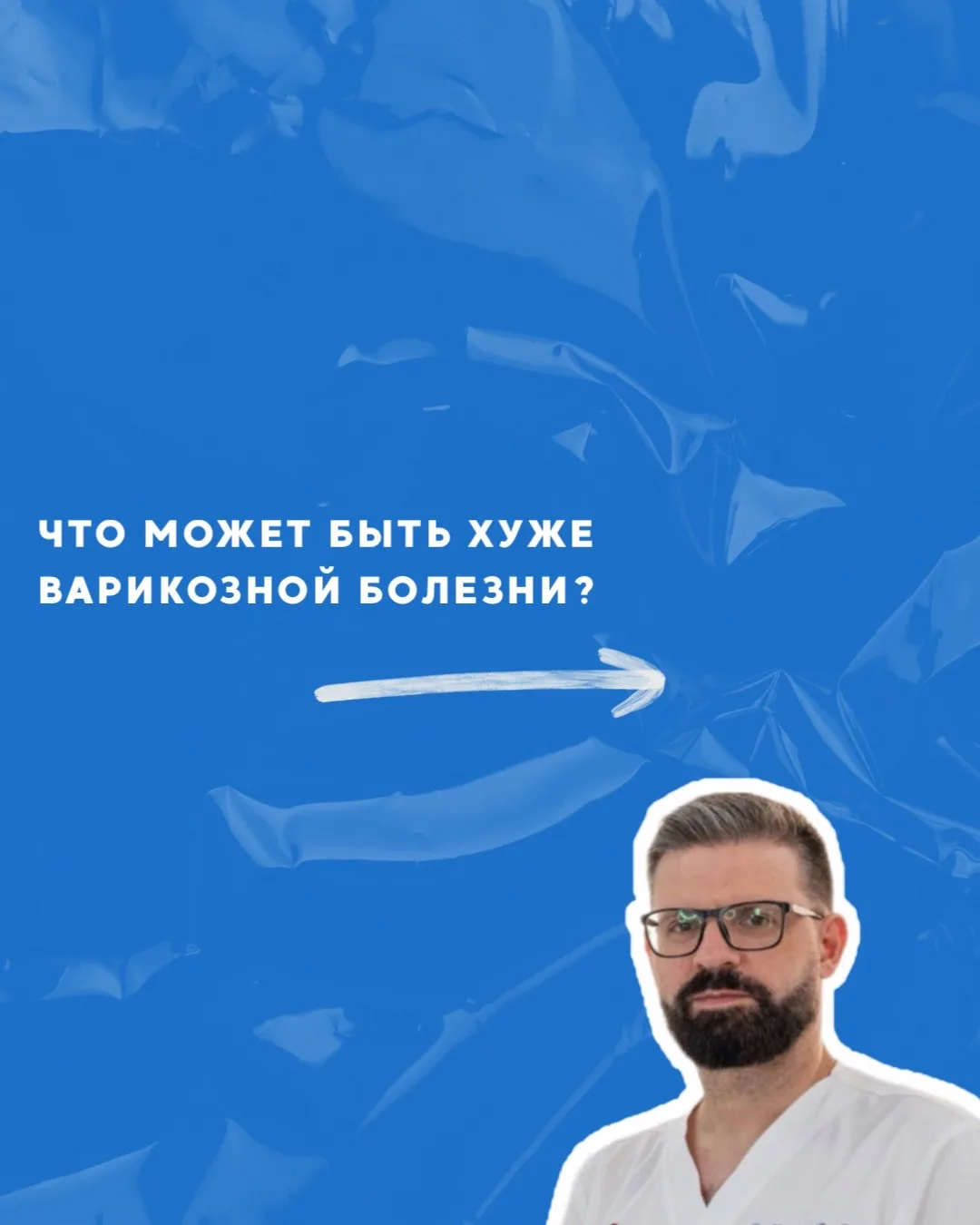 Тромбоз — это опасное заболевание вен, и одно из самых серьезных осложнений варикоза.