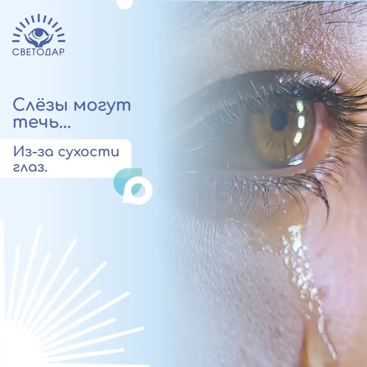 🥲Слёзы могут течь… из-за сухости глаз.