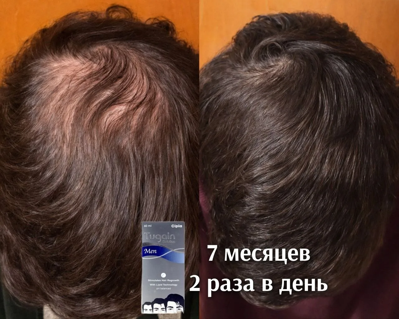 🌱Отлично успели вернуть за 7 месяцев и объем и структуру волоса.