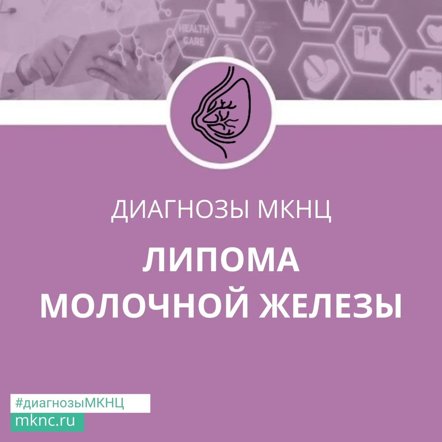 Липома молочной железы – это доброкачественное новообразование, которое развивается из ...
