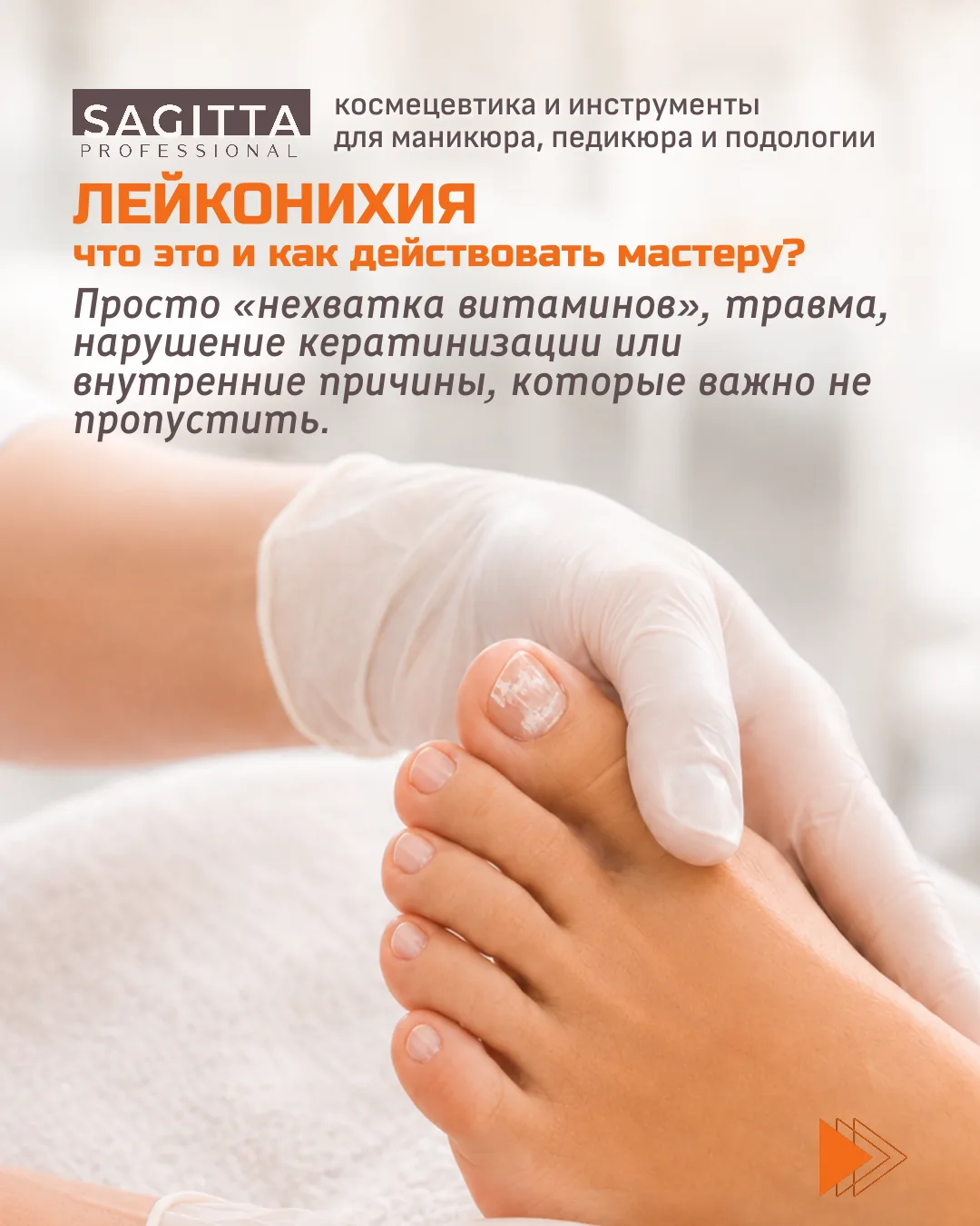Белые пятна на ногтях многие привыкли объяснять просто: «витаминов не хватает» или «где-то ударили н