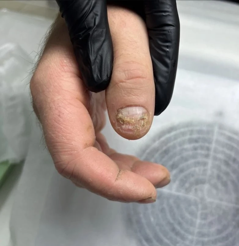 Мы работаем не только со стопами, но и с руками ✋🦶