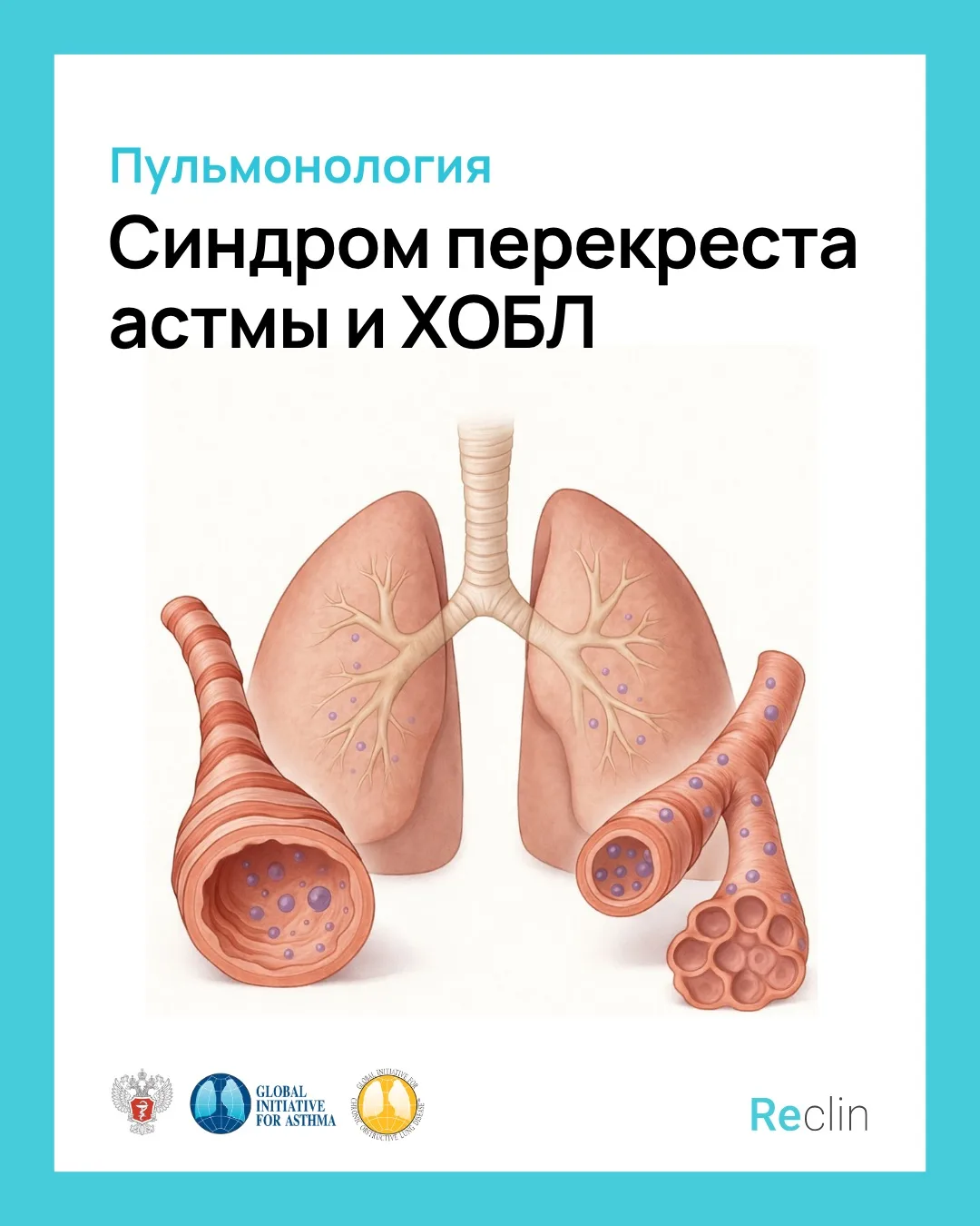 🫁 СИНДРОМ ПЕРЕКРЁСТА АСТМЫ И ХОБЛ 🫁

Астма или ХОБЛ? 🌬
А может всё сразу?!

🔮 Не гадаем, а повто