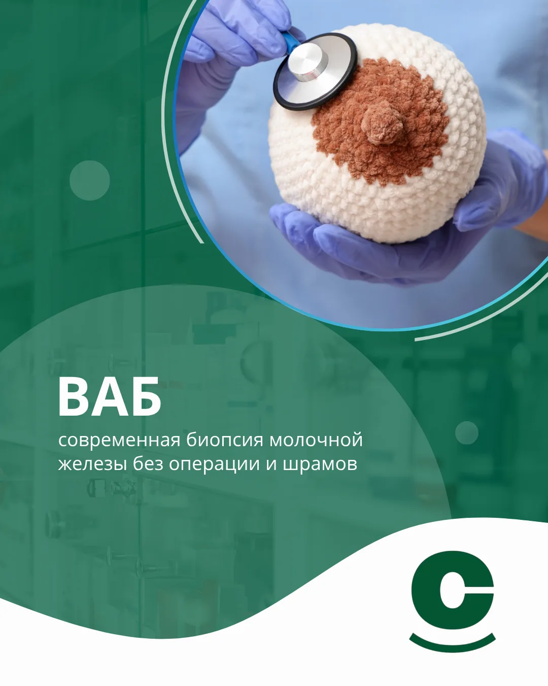 Современная диагностика рака молочной железы в клинике «СОВА»

Вакуумная аспирационная биопсия молоч