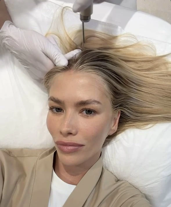 Лена Перминова выбирает FOTONA✨