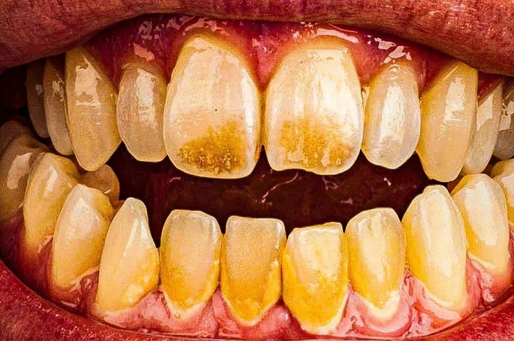 🦷Дружба начинается с улыбки — но сначала с гигиены.