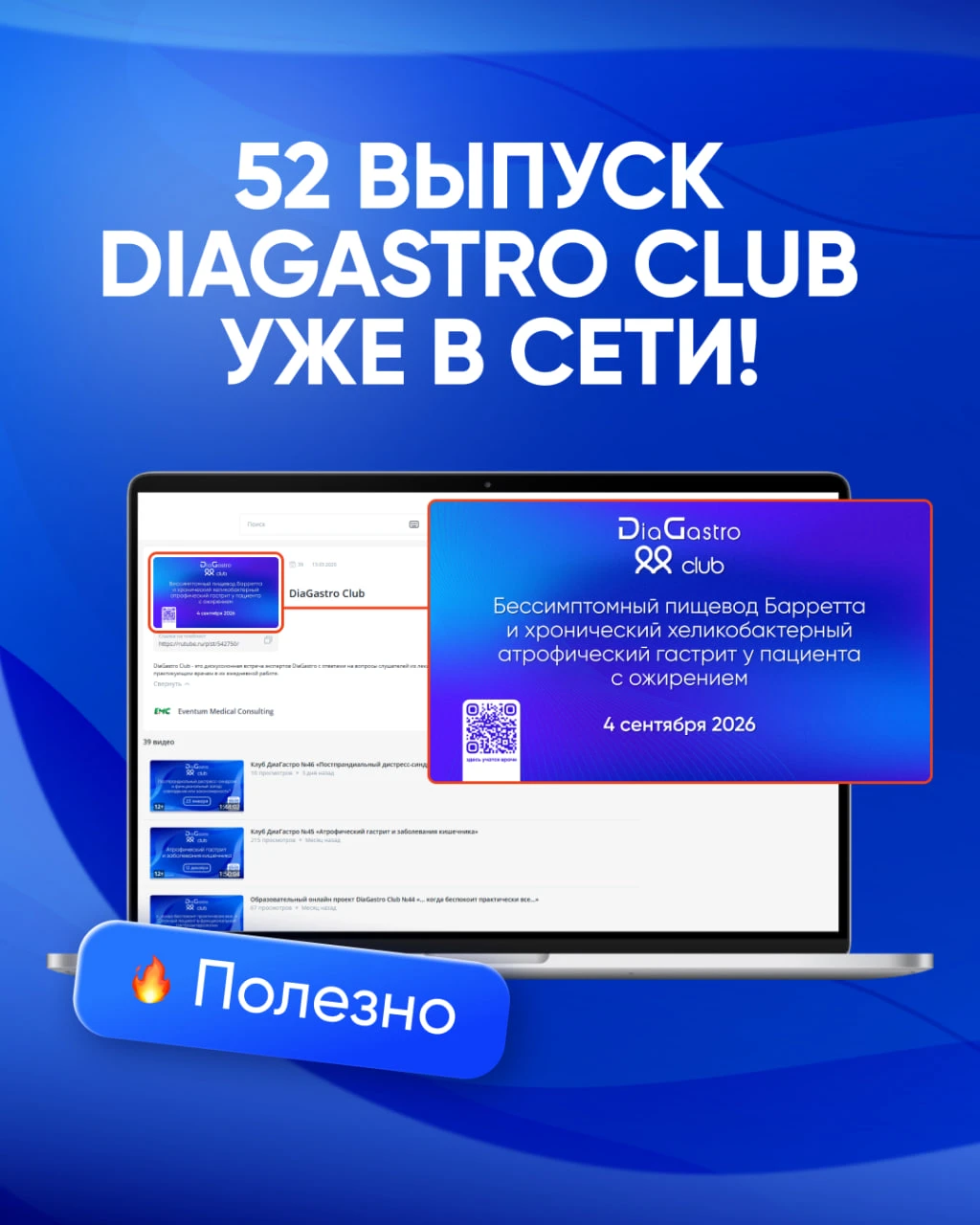 ➕ Уже сейчас в сети доступен 52-й выпуск DiaGastro Club «Бессимптомный пищевод Барретта...