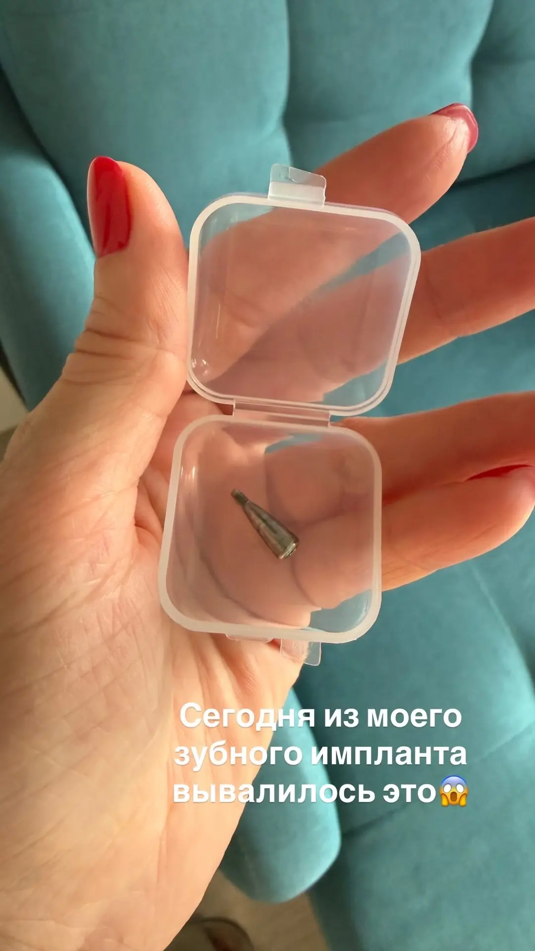 Только похвасталась, что все импланты прижились, как сегодня выпал расширитель десны. Ч...