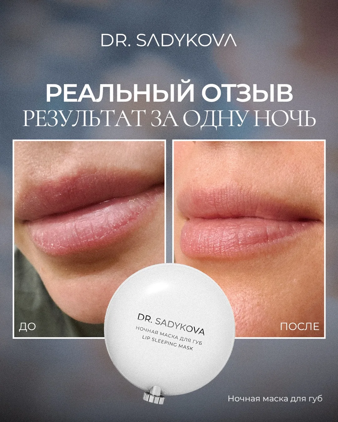 Многие ухаживают за кожей лица, но забывают, что губам тоже нужен отдельный уход.