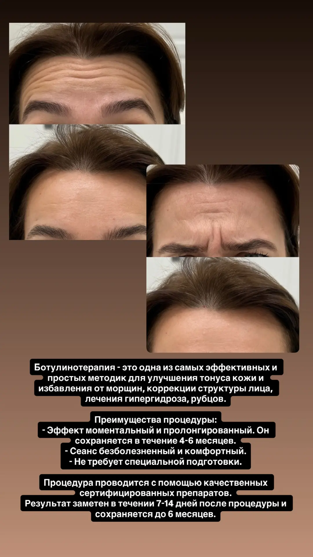 Стоимость 190₽/ед. Количество единиц определяется индивидуально.