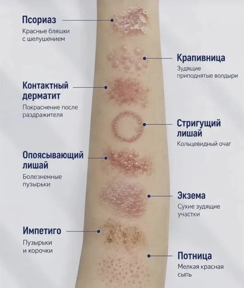 Кожные проявления