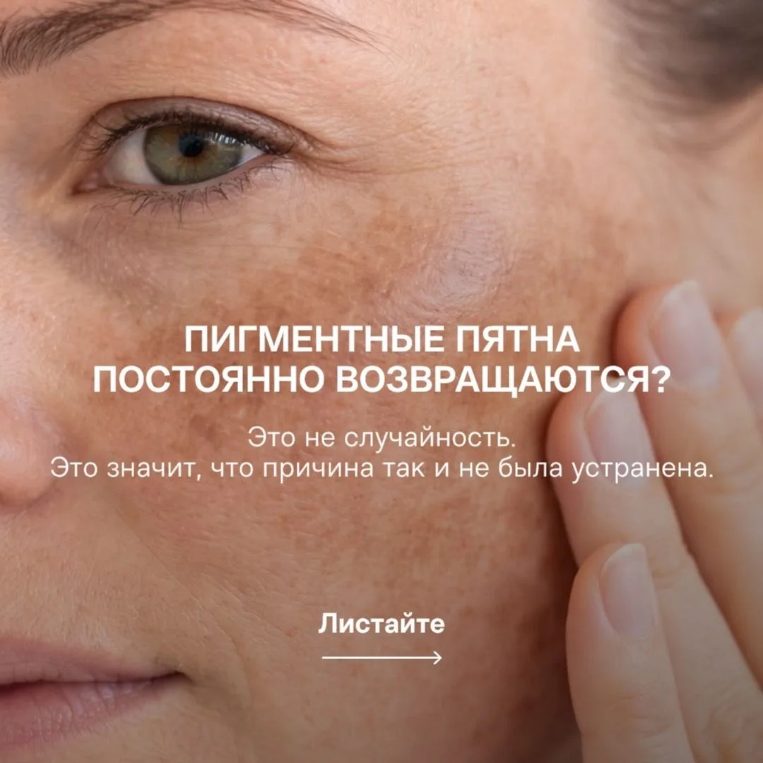 Если пигментные пятна возвращаются — значит, вы боролись со следствием, а не с причиной.