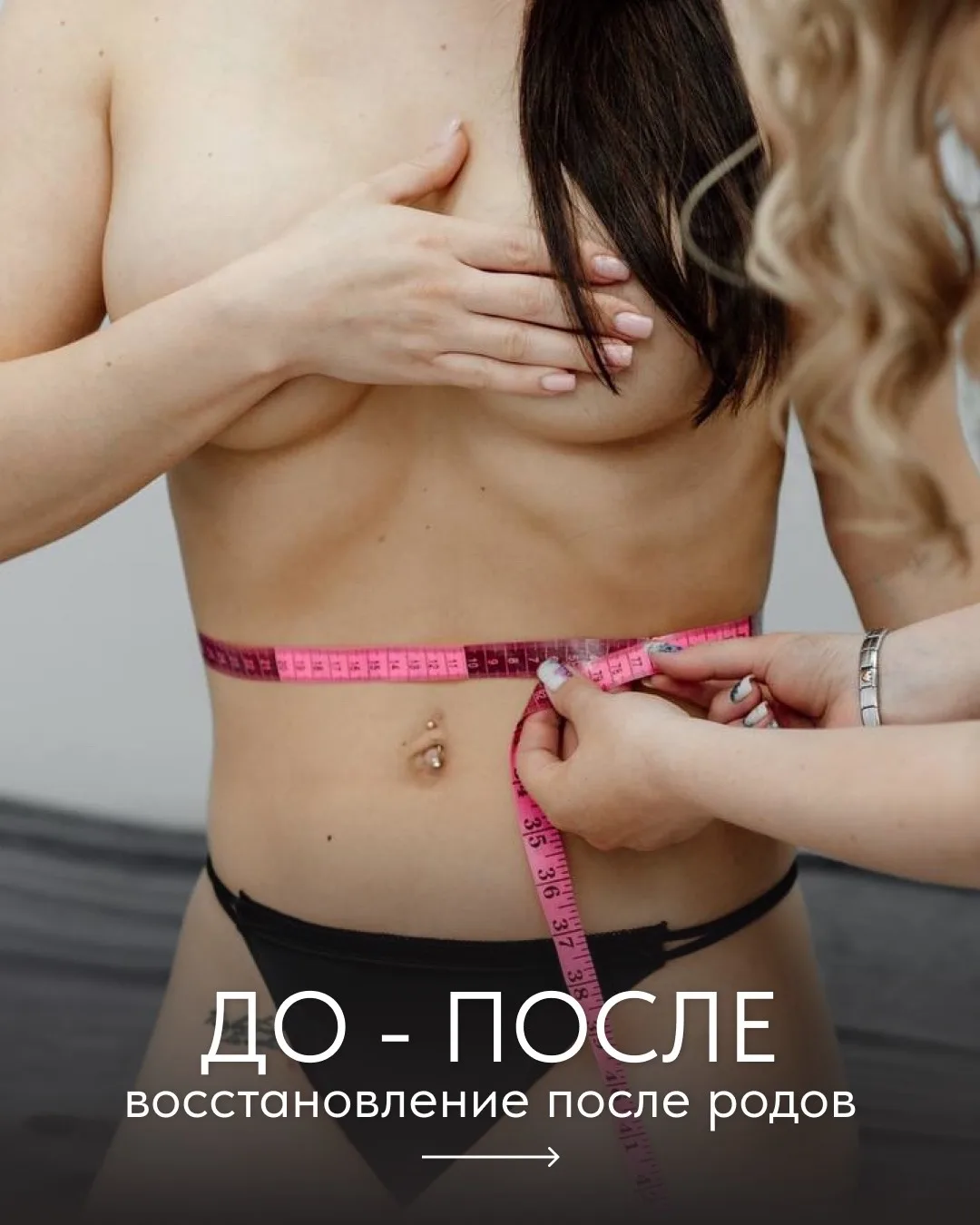 Впечатляющий результат коррекции фигуры после родов