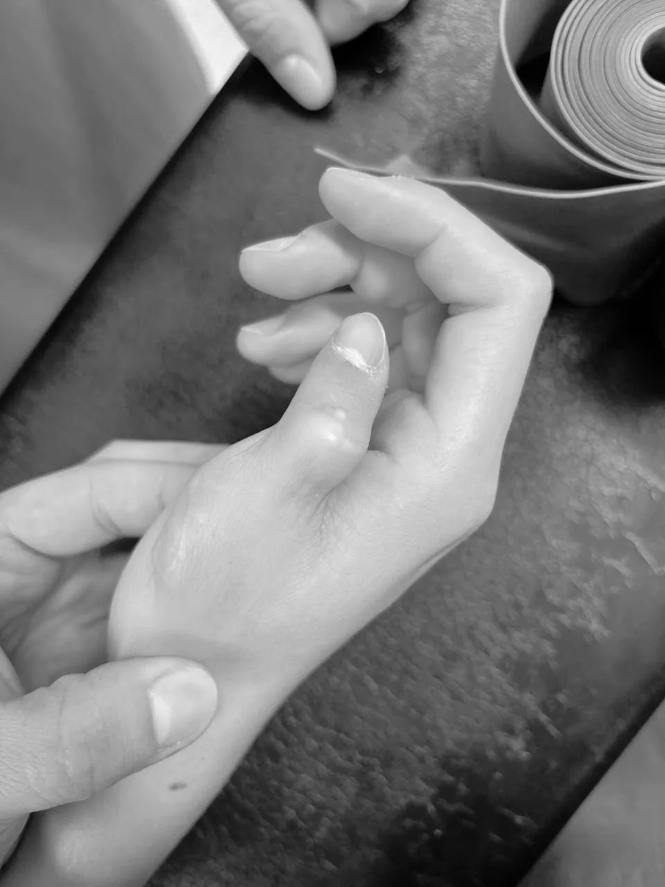 🖐 Врачи в Подмосковье исправили девочке деформацию пальца после резкого скачка роста