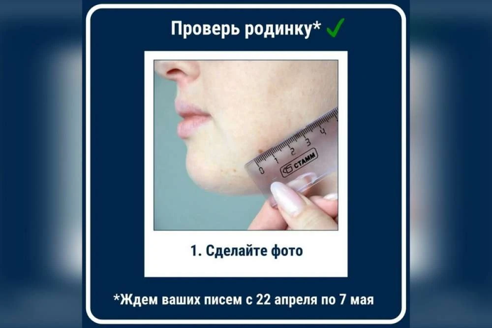 Врачи Красноярского края приглашают жителей региона проверить родинки   Проверить родинки перед нача