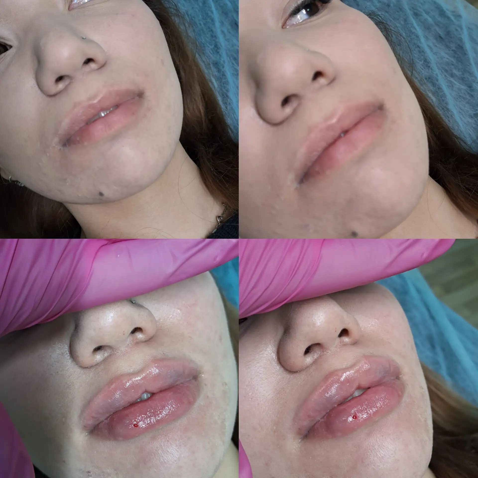 💋💋💋