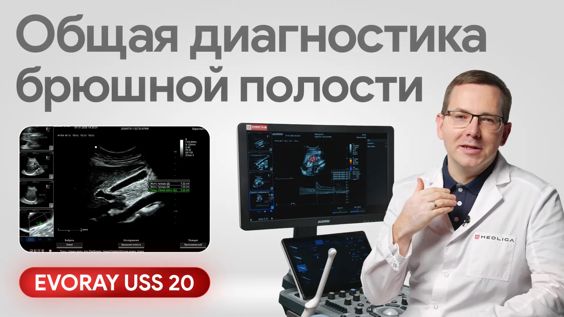 ❗️УЗИ брюшной полости: возможности EVORAY USS 20 в абдоминальной диагностике