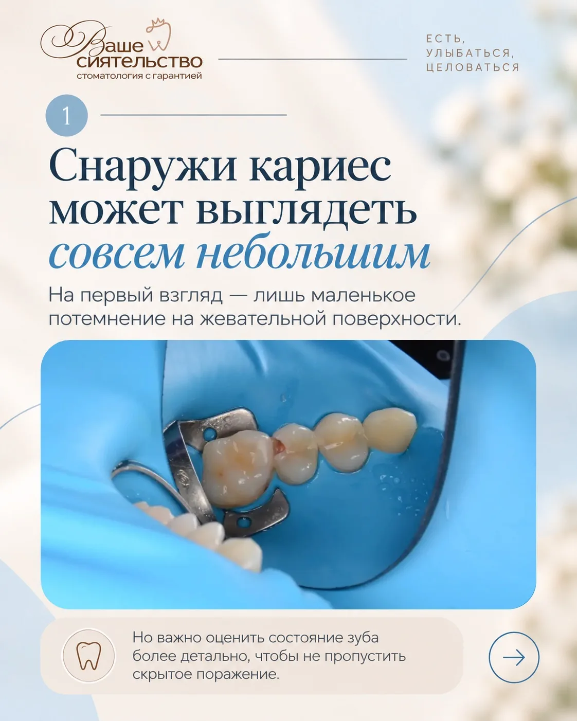 Маленькая точка на зубе может оказаться совсем не маленькой проблемой 🦷
