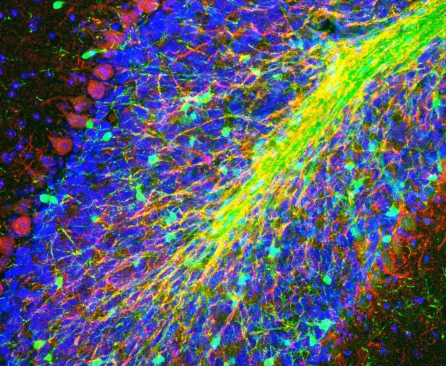 Белое вещество мозжечка

Наша новая картинка дня — снова с конкурса NeuroArt, на сей раз — июньского