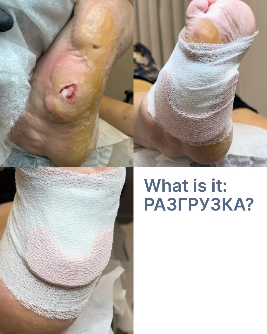 Каждый раз, когда мы делимся информацией о разгрузке, у вас возникают вопросы❓