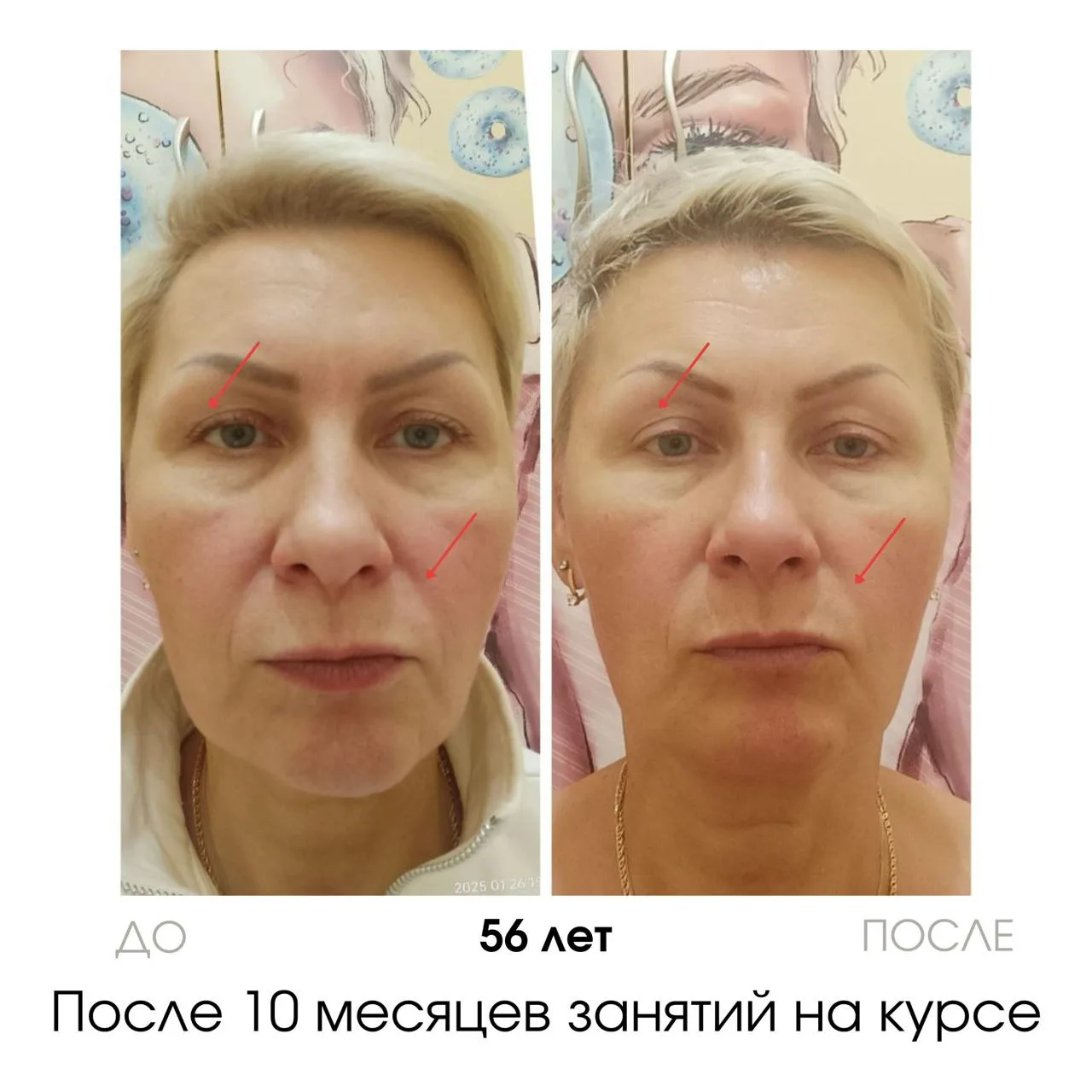 Как совмещать гимнастику и косметологов?  ФИНАЛЬНЫЙ ДЕНЬ АКЦИИ: anyclass.com/tg8  А примерно так, ка
