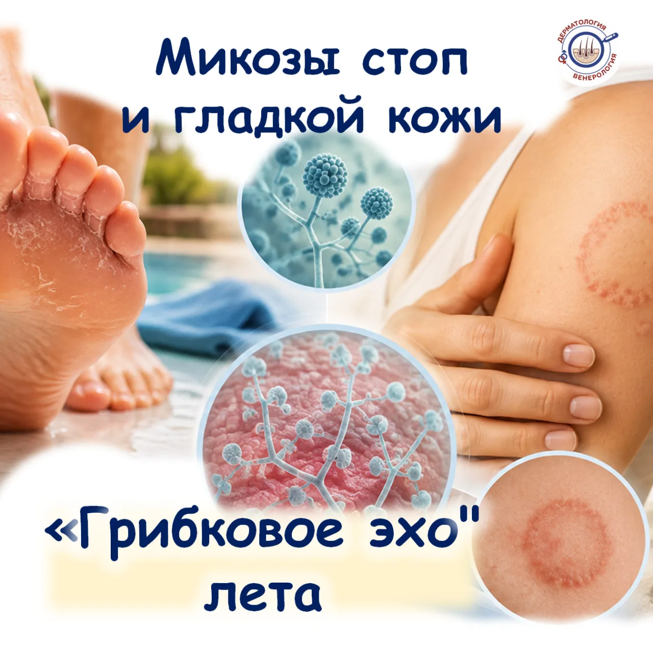 🦶 МИКОЗЫ СТОП И ГЛАДКОЙ КОЖИ: ПОЧЕМУ ГРИБОК ВОЗВРАЩАЕТСЯ СНОВА И СНОВА?
