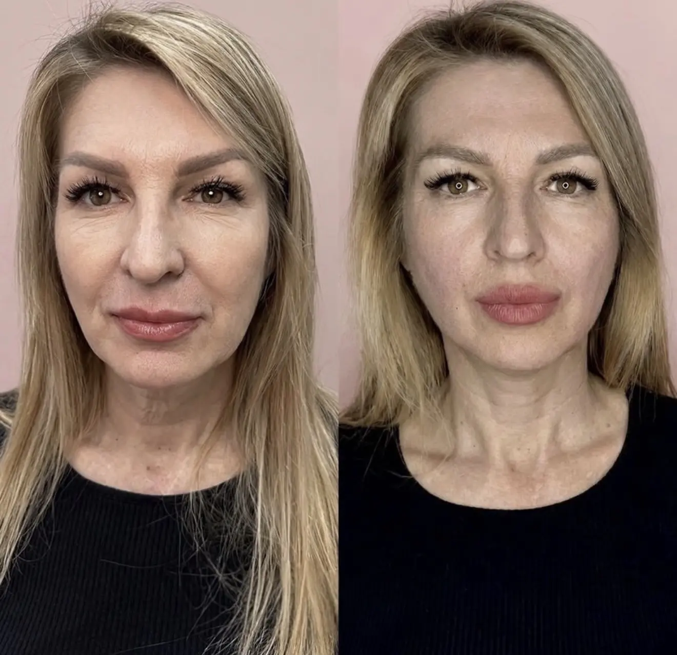 Девочки,у нас хорошая новость,для Вас мы продлили акцию ,скорее забирайте свободные око...