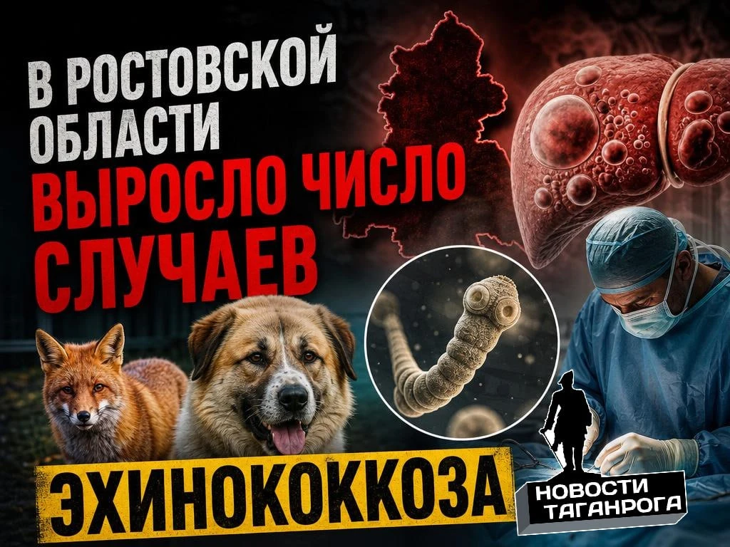 В Ростовской области выросло число случаев эхинококкоза