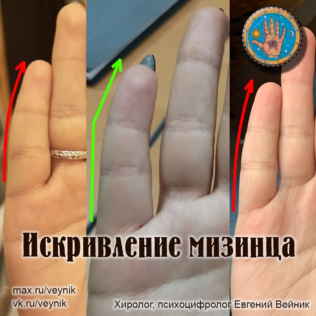 Изогнутый мизинец к пальцу Аполлона: что это означает?
‼ Обозначу сразу: соотношения изогнутого мизи