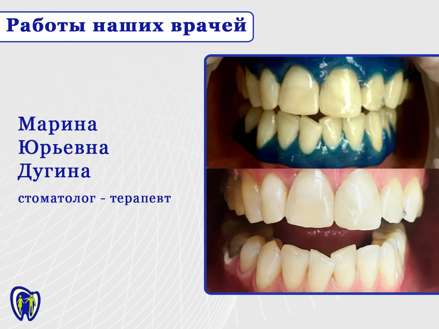 С наступлением летних дней запрос на "белые зубы" звучит в кабинете стоматолога всё чащ...